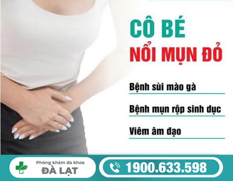 Hình ảnh minh họa
